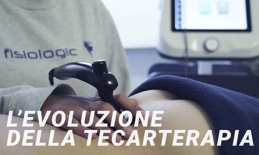 Ares - Elettroterapia biostimolante